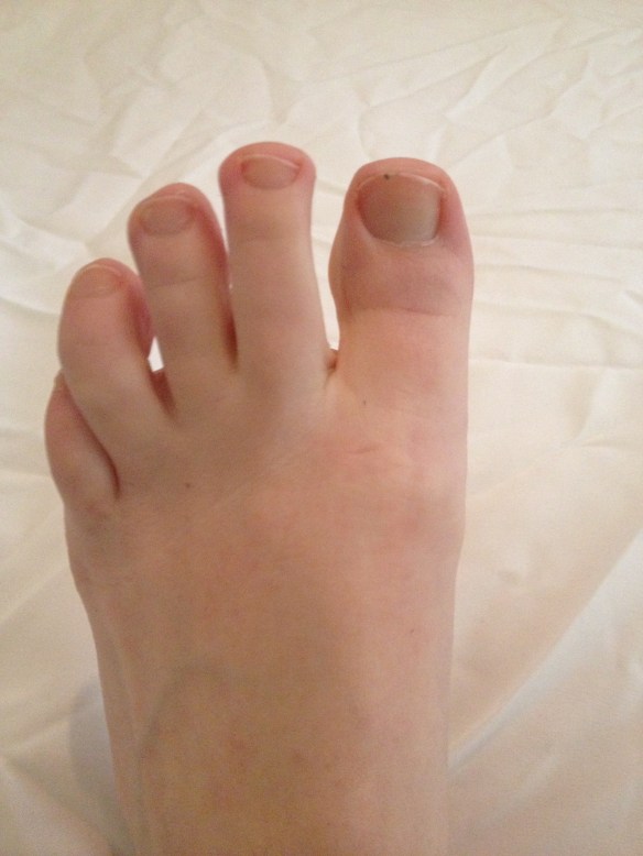 Here is a picture of my foot.